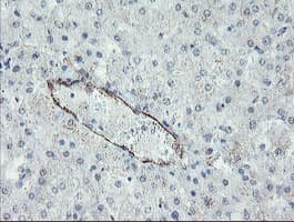 Monoclonal Mouse anti-Human PECAM-1 / CD31 Antibody (clone OTI1C2, IHC, WB)
