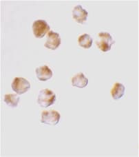 Polyclonal Rabbit anti-Human ACIN1 / Acinus Antibody (IF, WB)