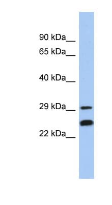 MMS21 / NSMCE2 Antibody (aa107-156)