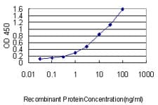 MAD2L1 / MAD2 Antibody (clone 2E2-1D6)