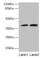 KLHDC8A Antibody