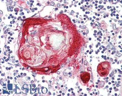 IHC-plus™ PI3 / Elafin Antibody