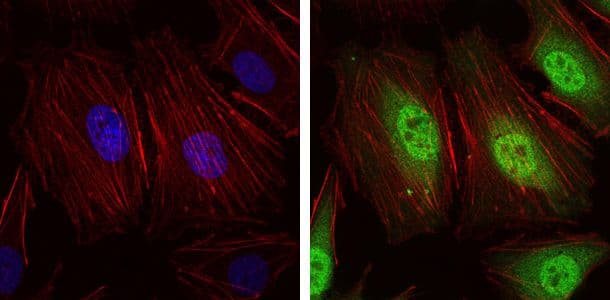 Monoclonal Mouse anti-Human NEDD8 Antibody (clone 1A7, IHC, IF, WB)
