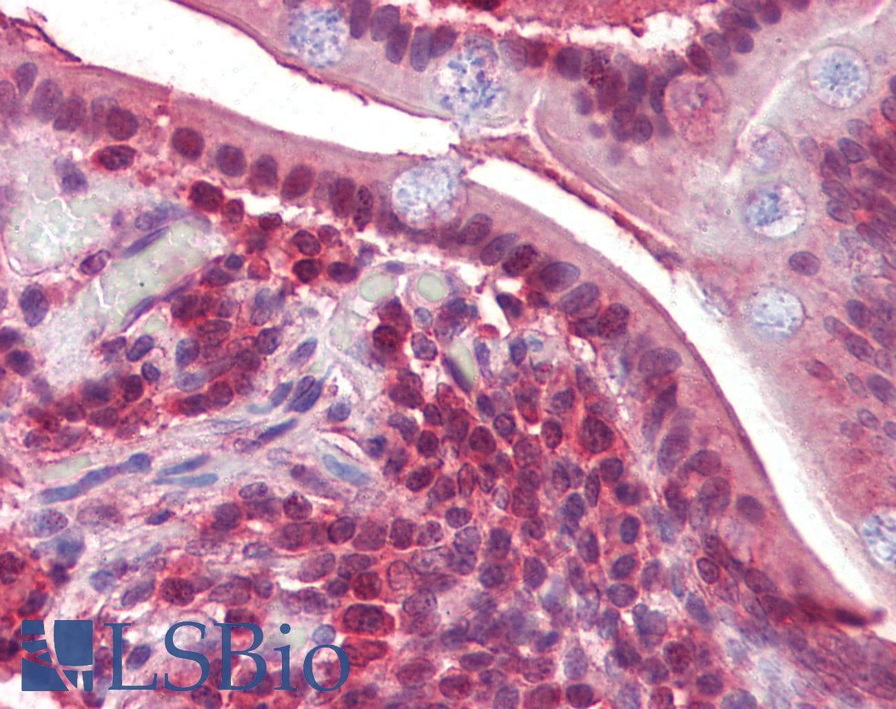 IHC-plus™ PPP4C Antibody (aa290-301)