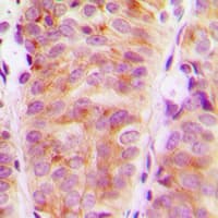 ARHGEF10 / GEF10 Antibody (Internal)