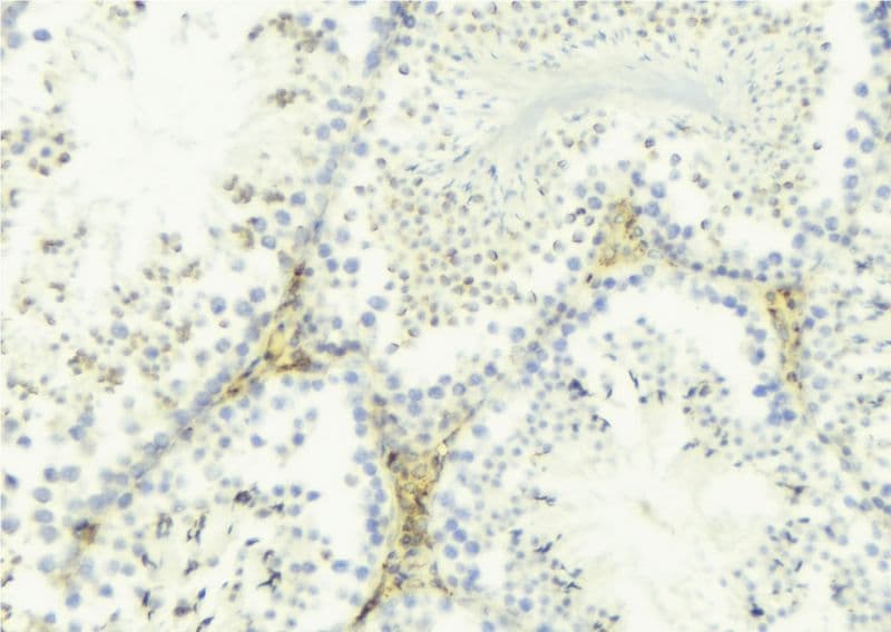 TNFSF12 / TWEAK Antibody