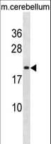 LIN7B Antibody (aa35-62)