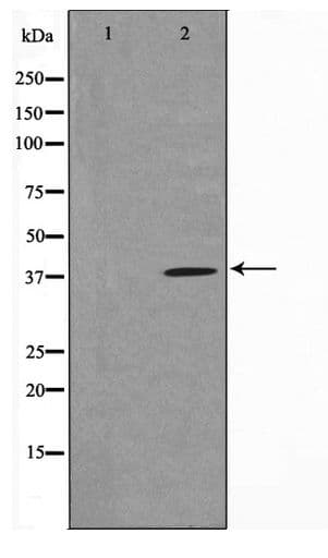 TUSC3 Antibody