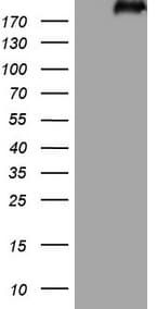LAMB2 / Laminin Beta 2 Antibody (aa314-561, clone OTI3B4, Carrier-free)