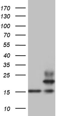 IHC-plus™ PPIF / Cyclophilin F Antibody (clone OTI7D12)