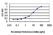 IHC-plus™ HNRNP-E2 / PCBP2 Antibody (clone 5F12)