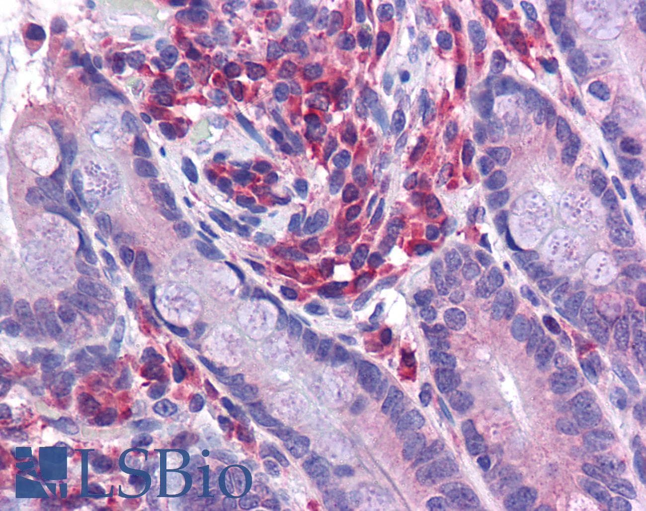 IHC-plus™ Polyclonal Rabbit anti-Human NOD3 / NLRC3 Antibody (IHC, IF, WB)