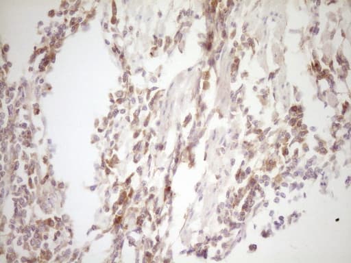 TFPI / LACI Antibody (aa29-304, clone OTI4H9, Carrier-free)