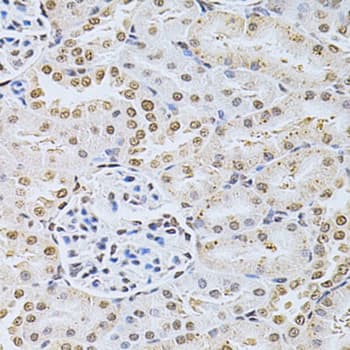 MDM2 Antibody