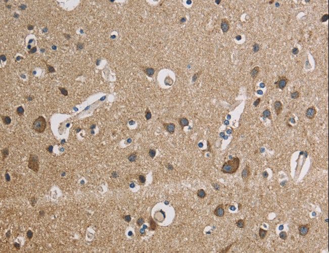 Polyclonal Rabbit anti-Human CYCS / Cytochrome c Antibody (IHC, WB)