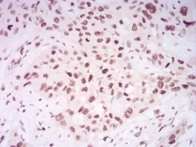 Monoclonal Mouse anti-Human HIST2H4A Antibody (clone 3E7D9, IHC)