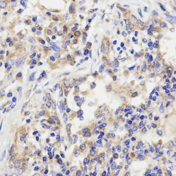 GRM3 / MGLUR3 Antibody