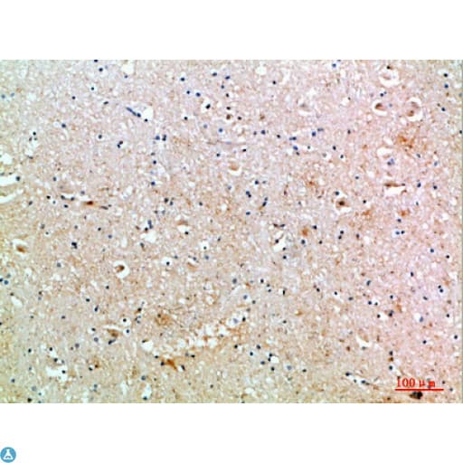 Polyclonal Rabbit anti-Human MIB1 Antibody (WB)