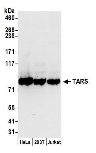 TARS Antibody (aa1-50)