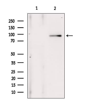 ANO1 / DOG1 / TMEM16A Antibody