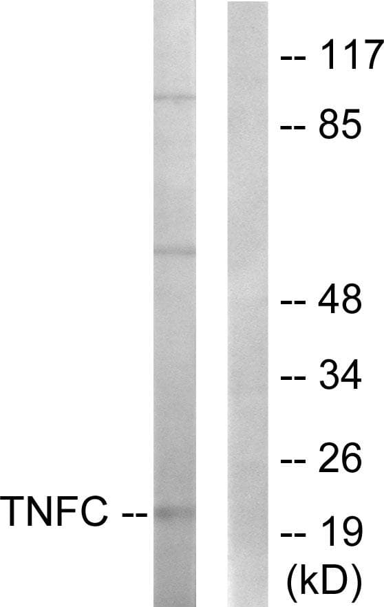 Lymphotoxin-Beta / LTB Antibody
