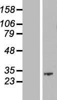 SKA1 Protein (Over-Expression Lysate Myc-DDK (Flag))