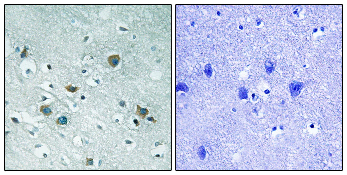 DPYSL2 / CRMP2 Antibody (phospho-Thr509)
