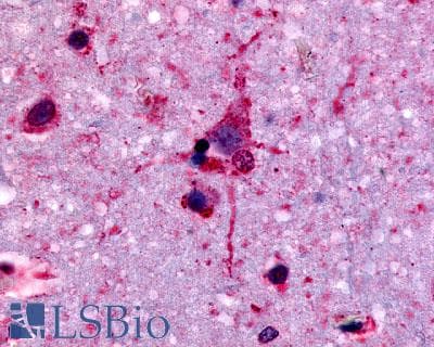 IHC-plus™ GPR45 Antibody (Extracellular Domain)
