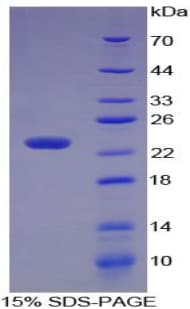 Human MMP3 Protein (Recombinant His-T7)