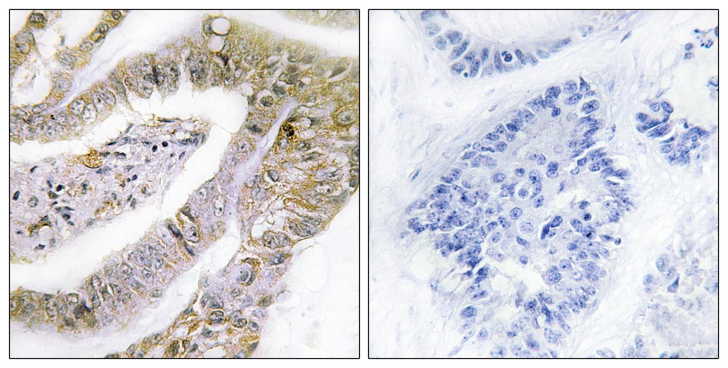 ERIC-1 / TACC3 Antibody