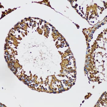 Polyclonal Rabbit anti-Human IRAK4 / IRAK-4 Antibody (IHC, WB)