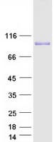 Human ADD3 Protein (Recombinant Myc-DDK (Flag))