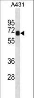 CILD9 / DNAI2 Antibody (aa484-513)