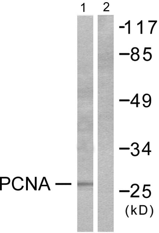 Polyclonal Rabbit anti-Human PCNA Antibody (IHC, WB)