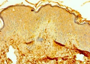 Polyclonal Rabbit anti-Human RMDN3 Antibody (aa171-470, IHC, WB)