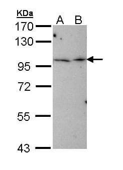 TBCK / TBCKL Antibody (aa457-694)