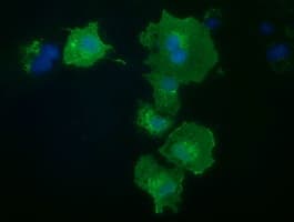 Monoclonal Mouse anti-Human PRKD2 / PKD2 Antibody (clone OTI3B12, IF, WB)