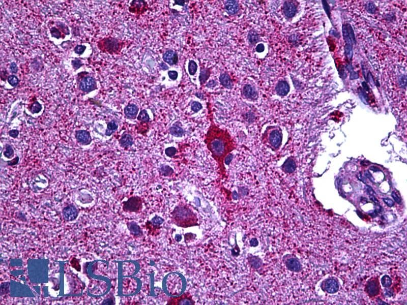 IHC-plus™ GAD / Glutamate Decarboxylase Antibody (aa545-594)