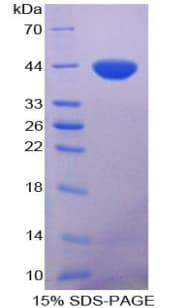 Human NFKB1 / NF-Kappa-B Protein (Recombinant His-GST)