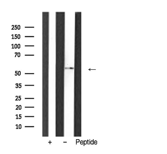 HNF1B / HNF1 Beta Antibody