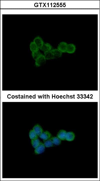 Polyclonal Rabbit anti-Human DLST / E2 Antibody (aa188-453, IHC, WB)