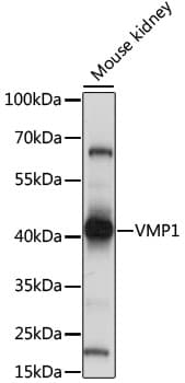 TMEM49 Antibody