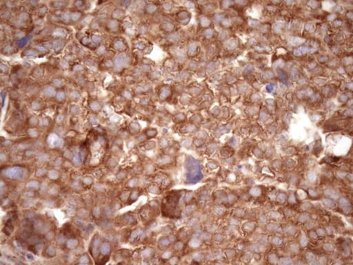 RPL10 / Ribosomal Protein L10 Antibody (clone OTI6B11)