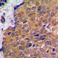 AKT1 + AKT2 + AKT3 Antibody (C-Terminus)