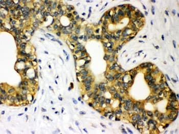 Polyclonal Rabbit anti-Human STAT1 Antibody (IHC, WB)