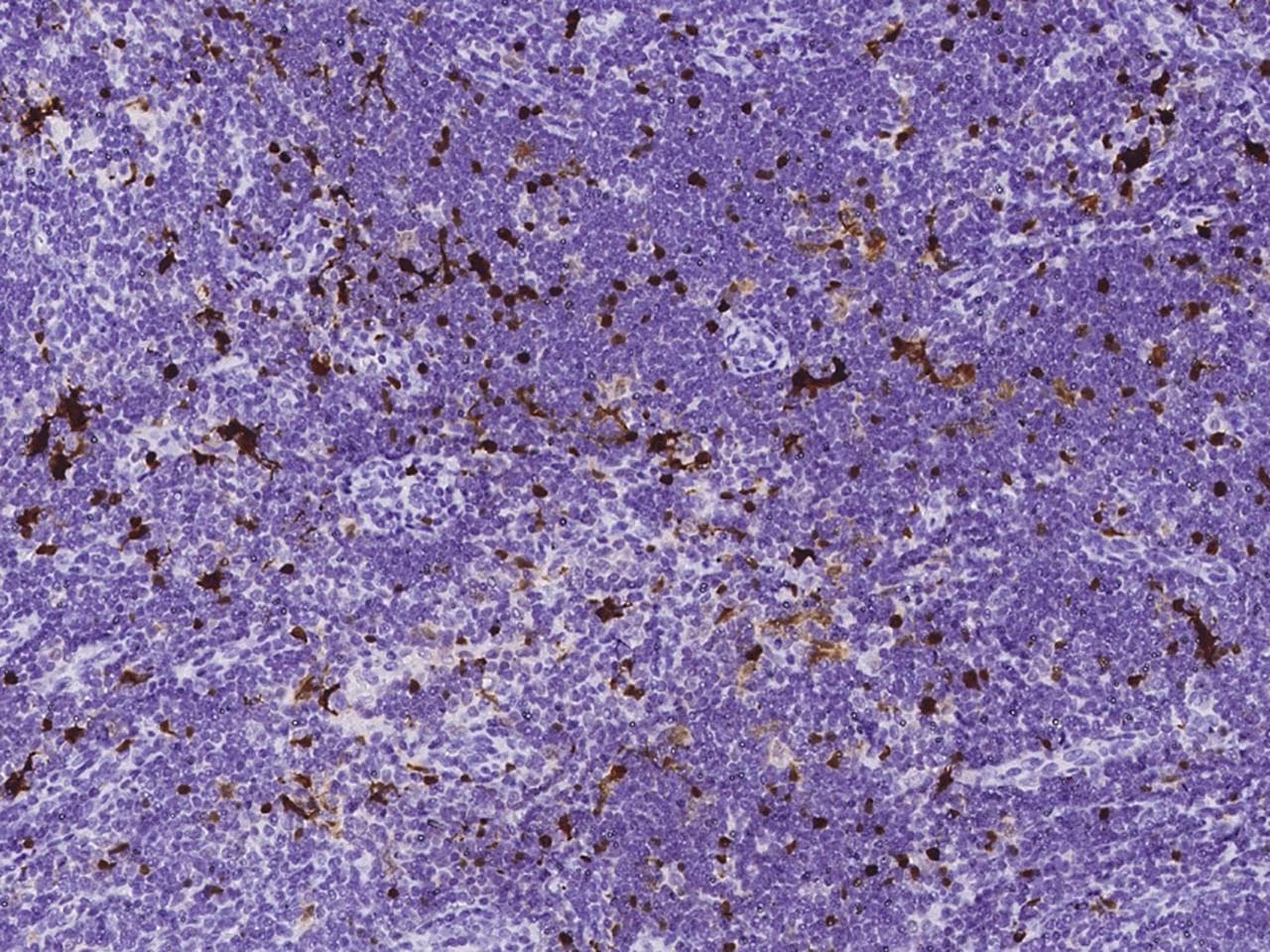 Monoclonal Mouse anti-Human S100B / S100 Beta Antibody (clone 03, Preservative Free, IHC)