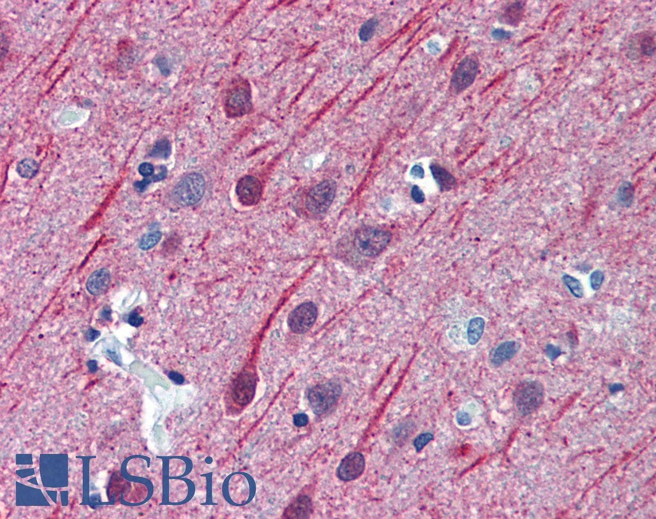 IHC-plus™ TUBB2A / Tubulin Beta 2A Antibody (clone 3B2)