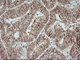 MAP2K1 / MKK1 / MEK1 Antibody (clone OTI2B7)