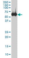 IHC-plus™ CES2 / Esterase Antibody (clone 4F12)