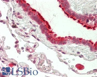 IHC-plus™ Polyclonal Rabbit anti-Human SLC16A11 Antibody (aa48-76, IHC, WB)